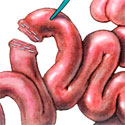 medical illustration 