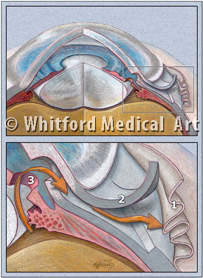 Medical illustration eye trabeculectomy surgery